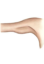 Брахиопластика - подтяжка рук