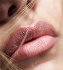 Chelioplasty - Plastic surgery on lips